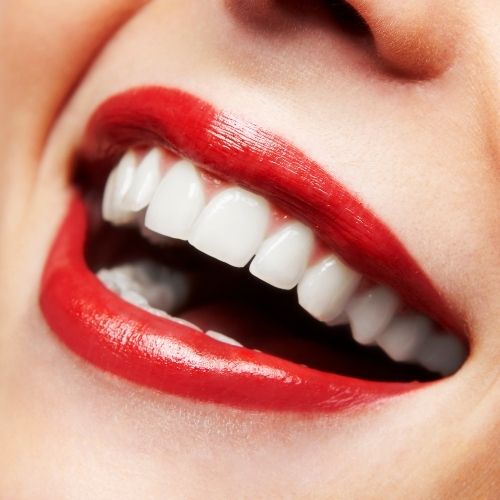 Teeth whitening for perfect smile