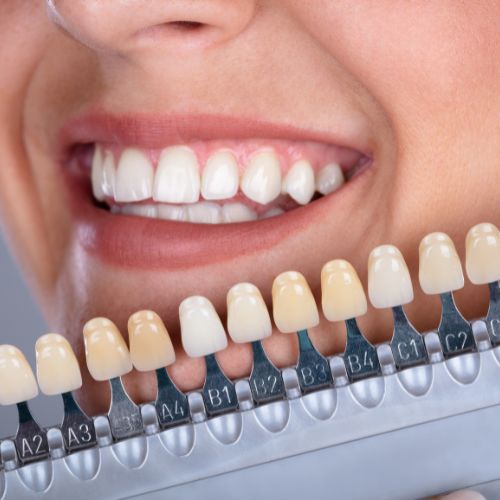 Dental Implants in Larnaca Cyprus by BestDentistLarnaca.com