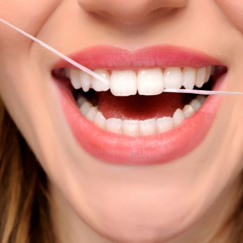 Brushing and flossing prevent yellow teeth by Dental clinic in Larnaca